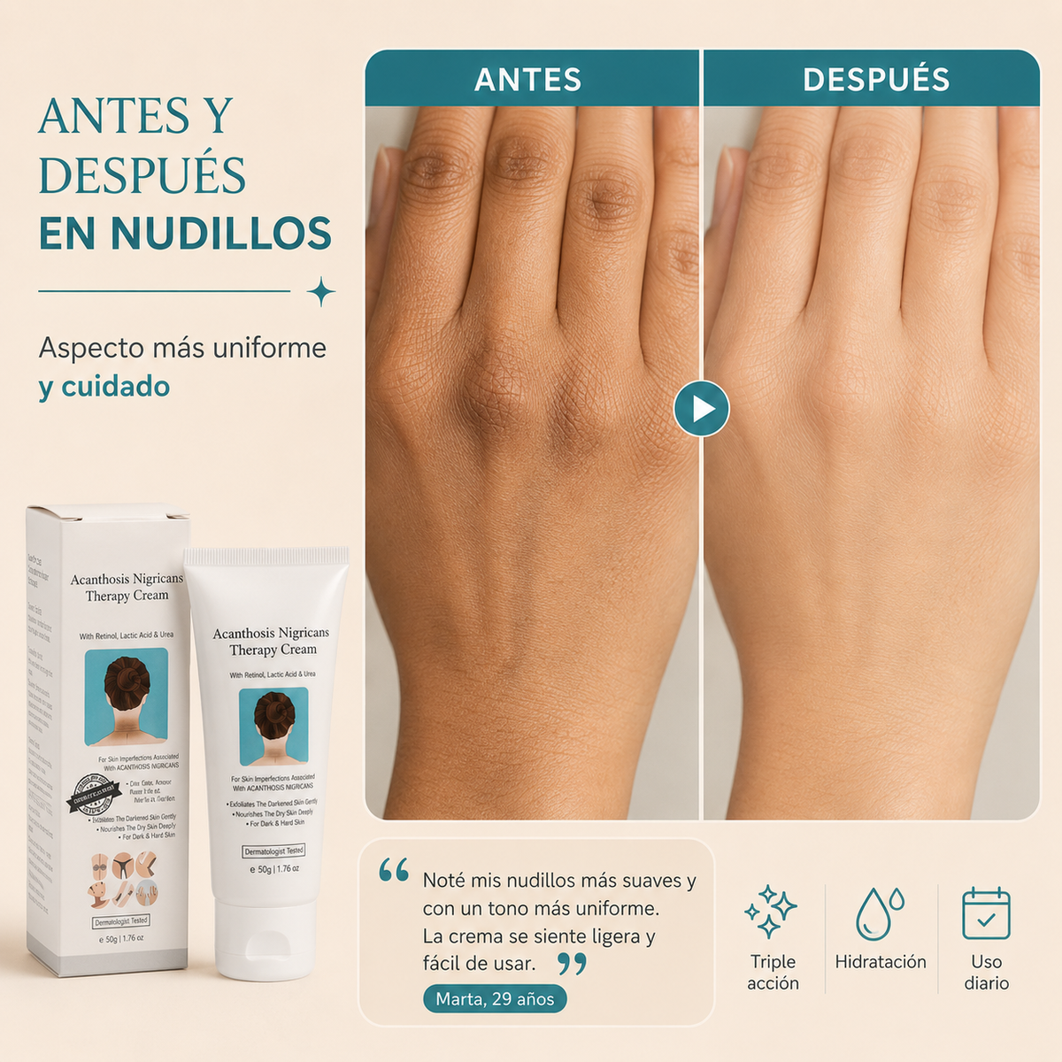 Crema aclarante blanqueadora