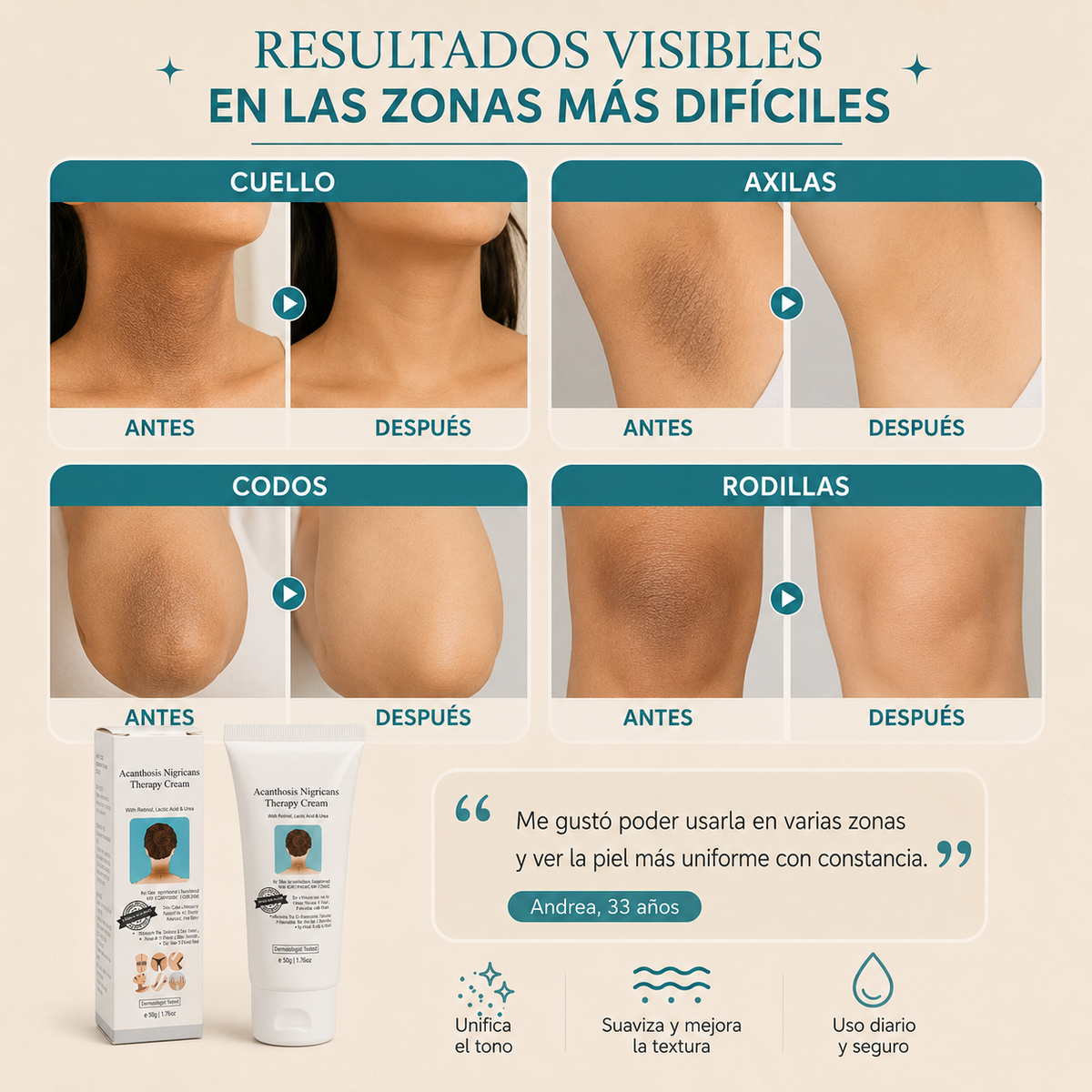 Crema aclarante blanqueadora