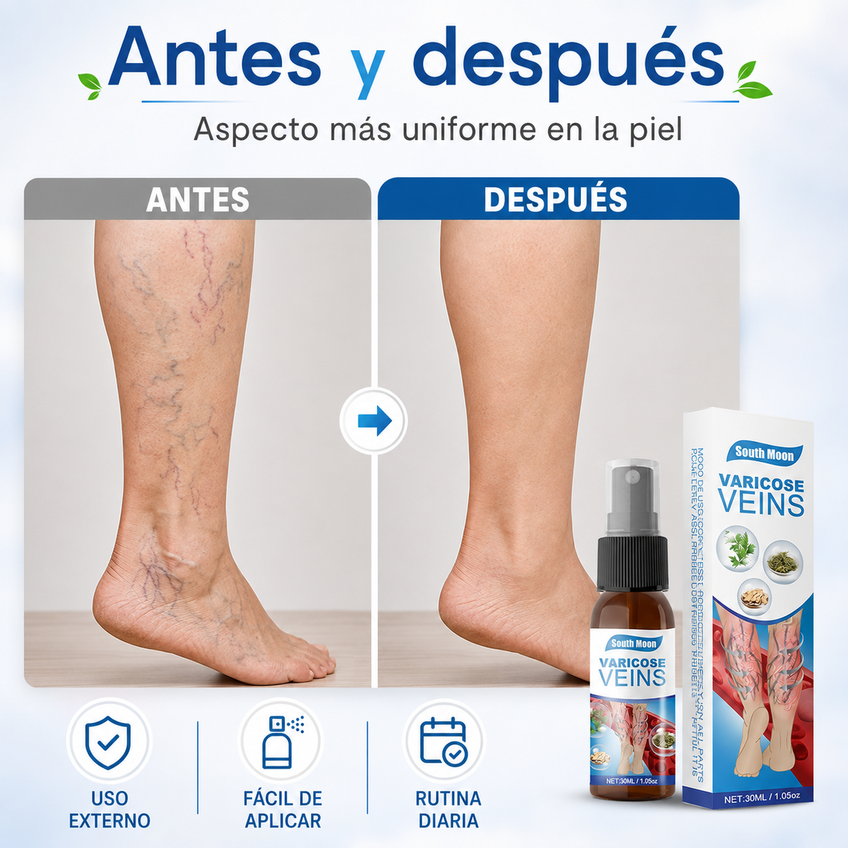 Spray para Varices