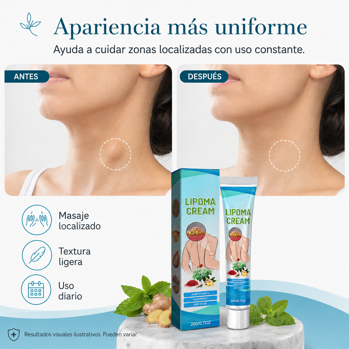 Crema para reducir bultos de grasa (lipomas)